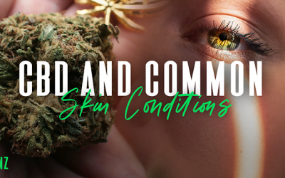 CBD and The Skin – How CBD Can Help Common Skin Conditions